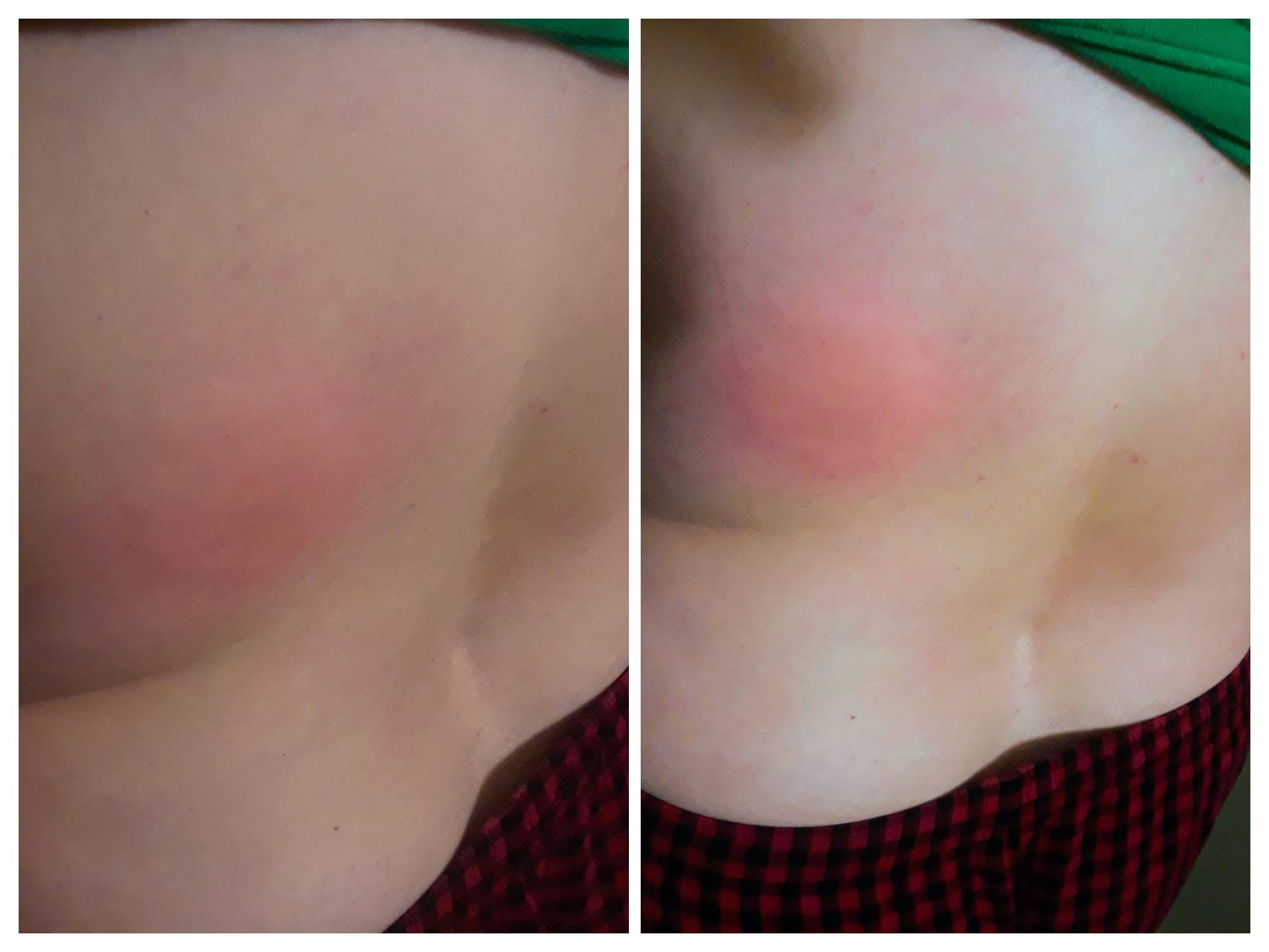 Image documenting chronic back injuries